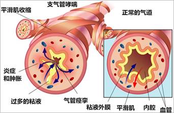http://health.people.com.cn/NMediaFile/2016/1111/MAIN201611111319000238592908982.jpg